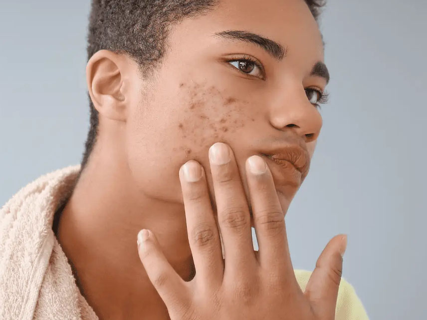 _0019_How Gut Health influences Your Skin_ The Digestive and Clear Skin Connection